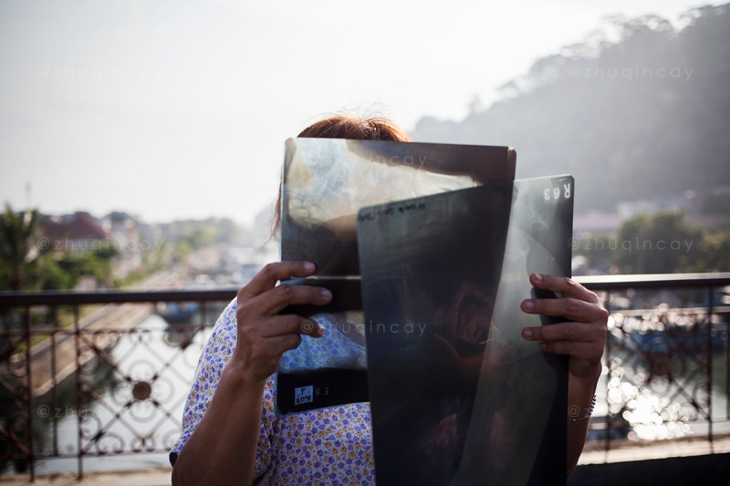 Seorang warga memperlihatkan kertas film rontgen yang digunakan untuk melihat fenomena gerhana matahari total di Padang, Rabu, 9 Maret 2016.
